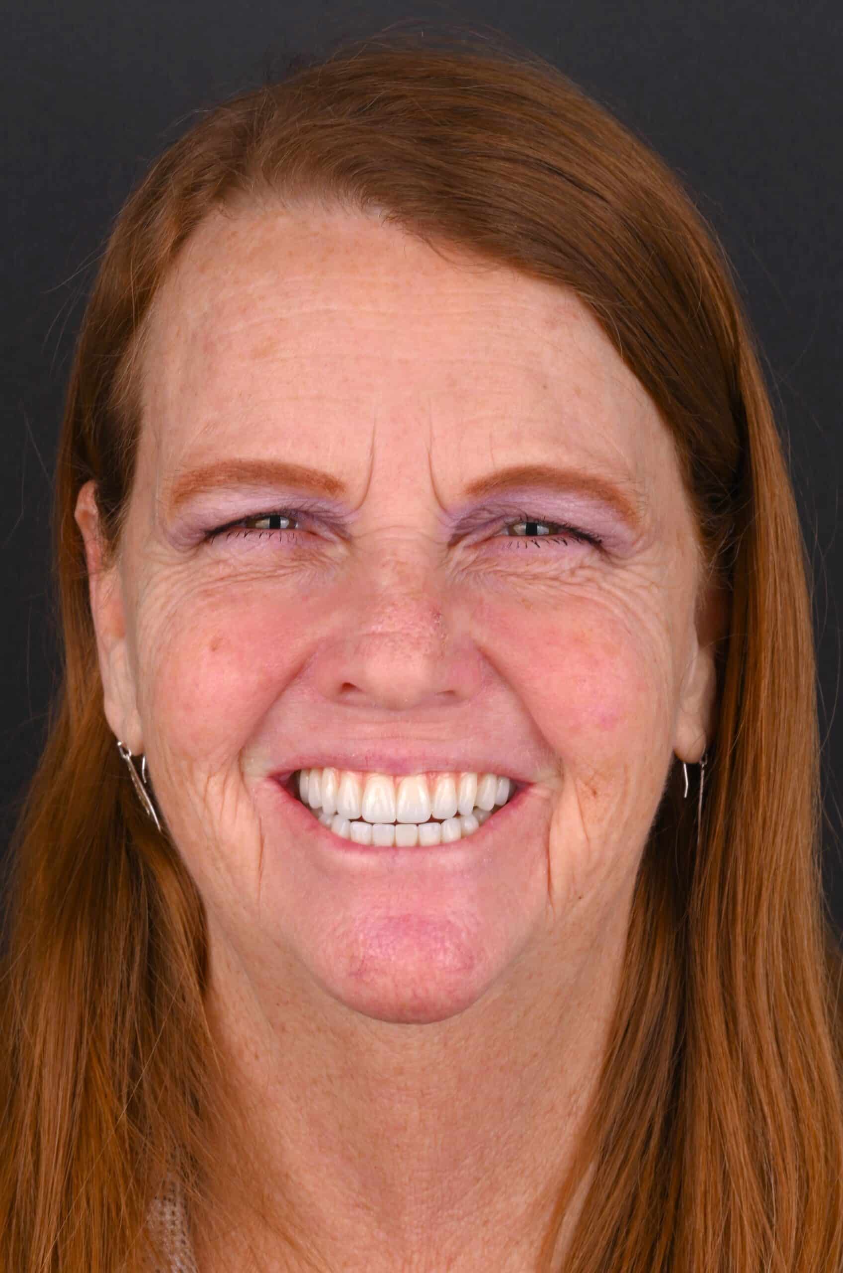 Close-up of a smiling red-haired woman against a dark background, showing her teeth.