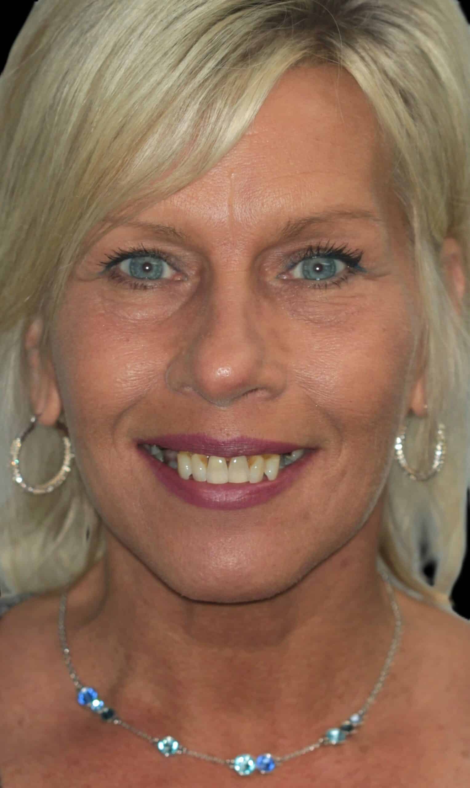 Close-up portrait of a smiling blonde woman with blue eyes, wearing hoop earrings and a blue gemstone necklace.
