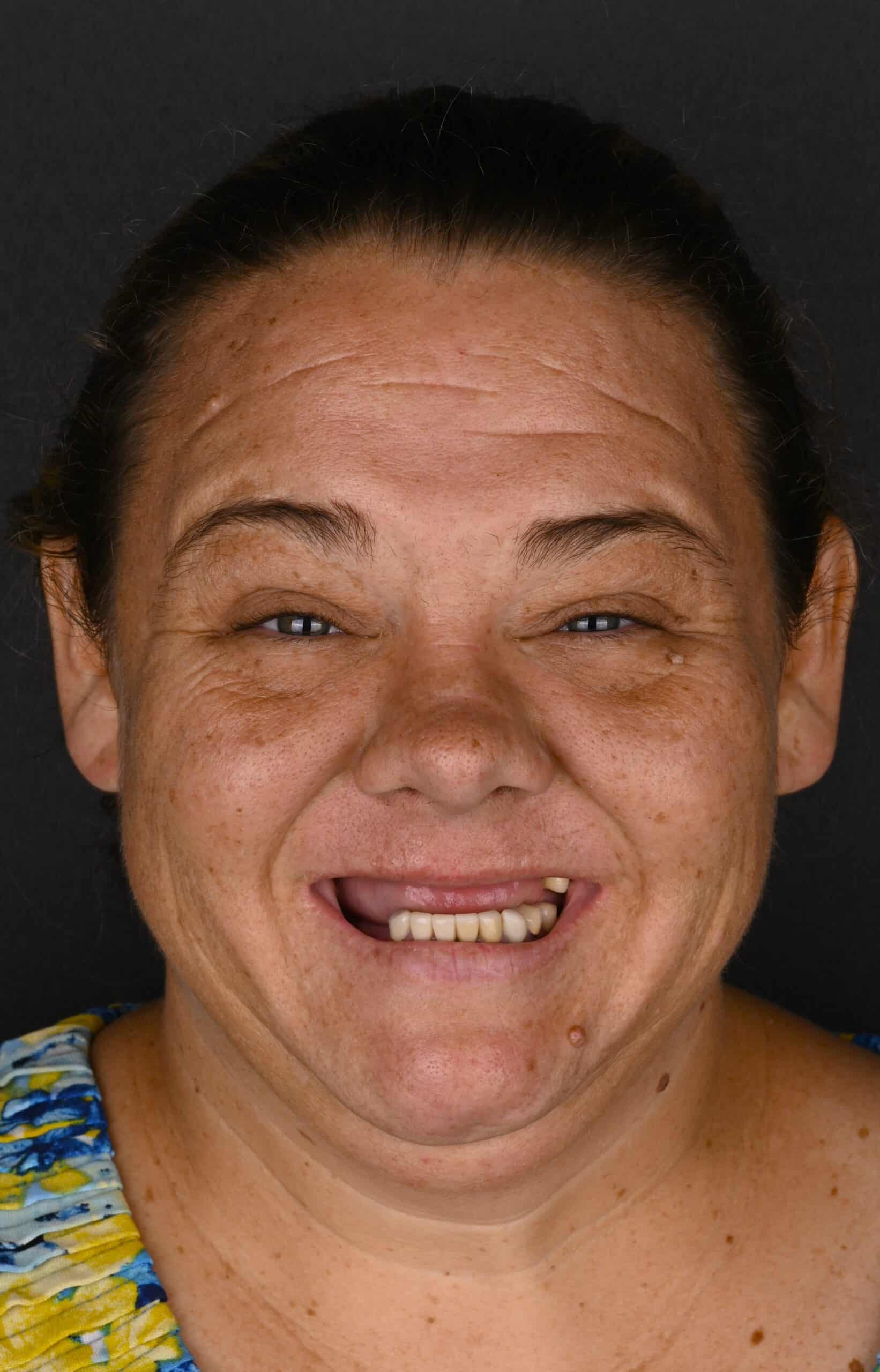 Close-up of a smiling woman with dark hair pulled back, visible freckles and teeth showing.