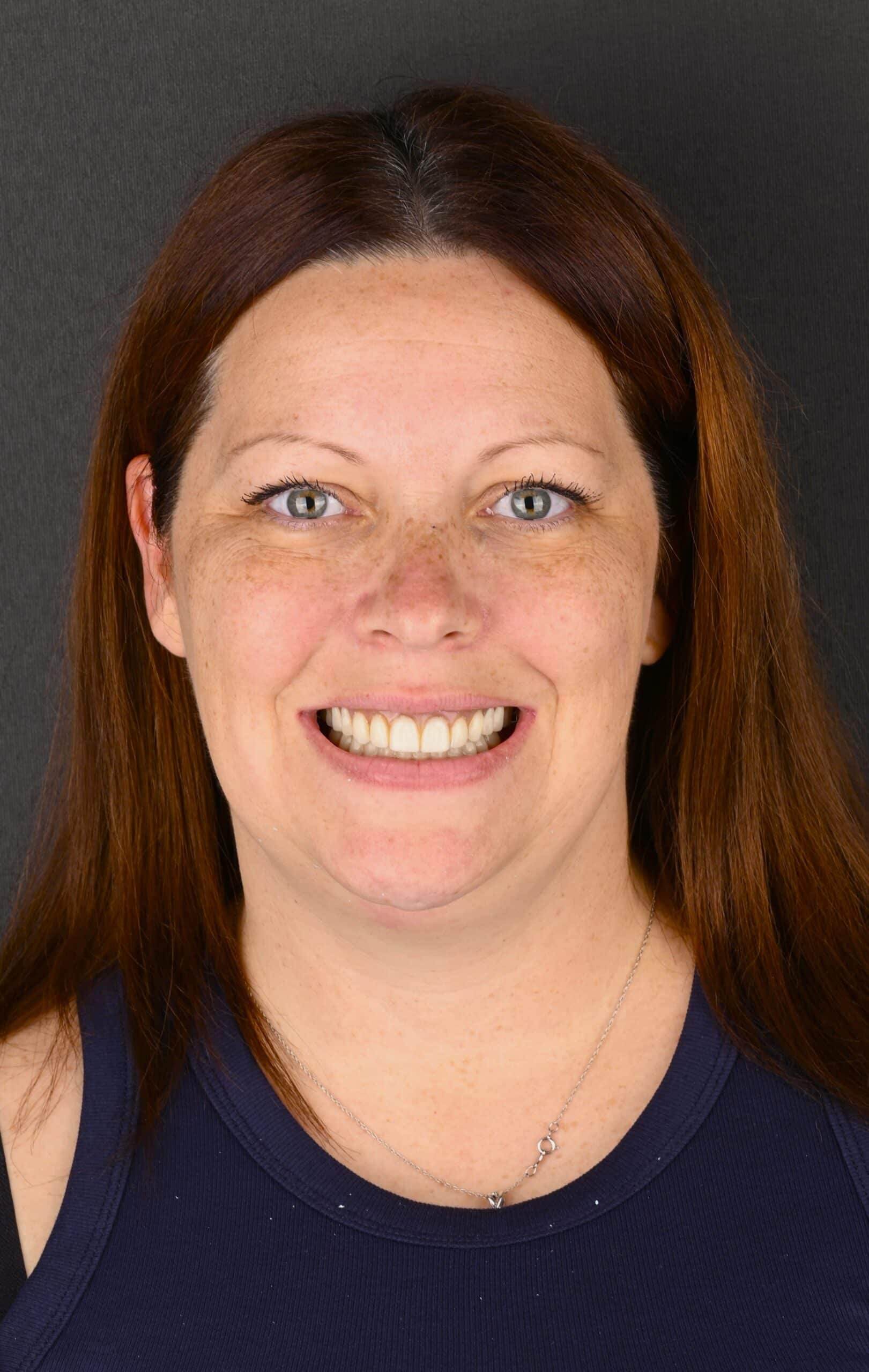 Close-up portrait of a smiling woman with freckles and blue-green eyes, wearing a navy sleeveless top, dark background.
