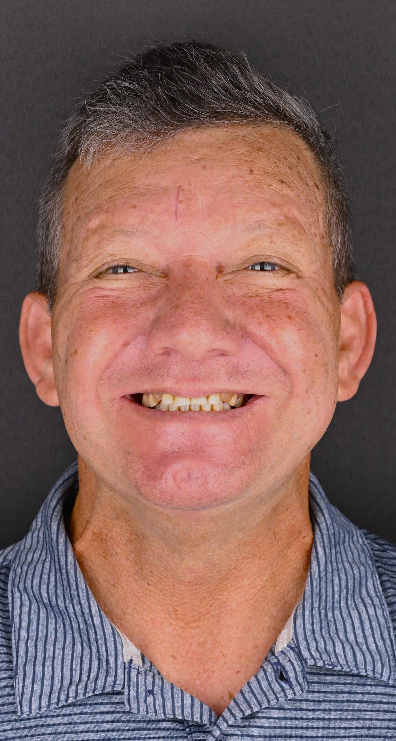Smiling middle-aged man with short gray hair wearing a striped blue shirt, against a dark background.
