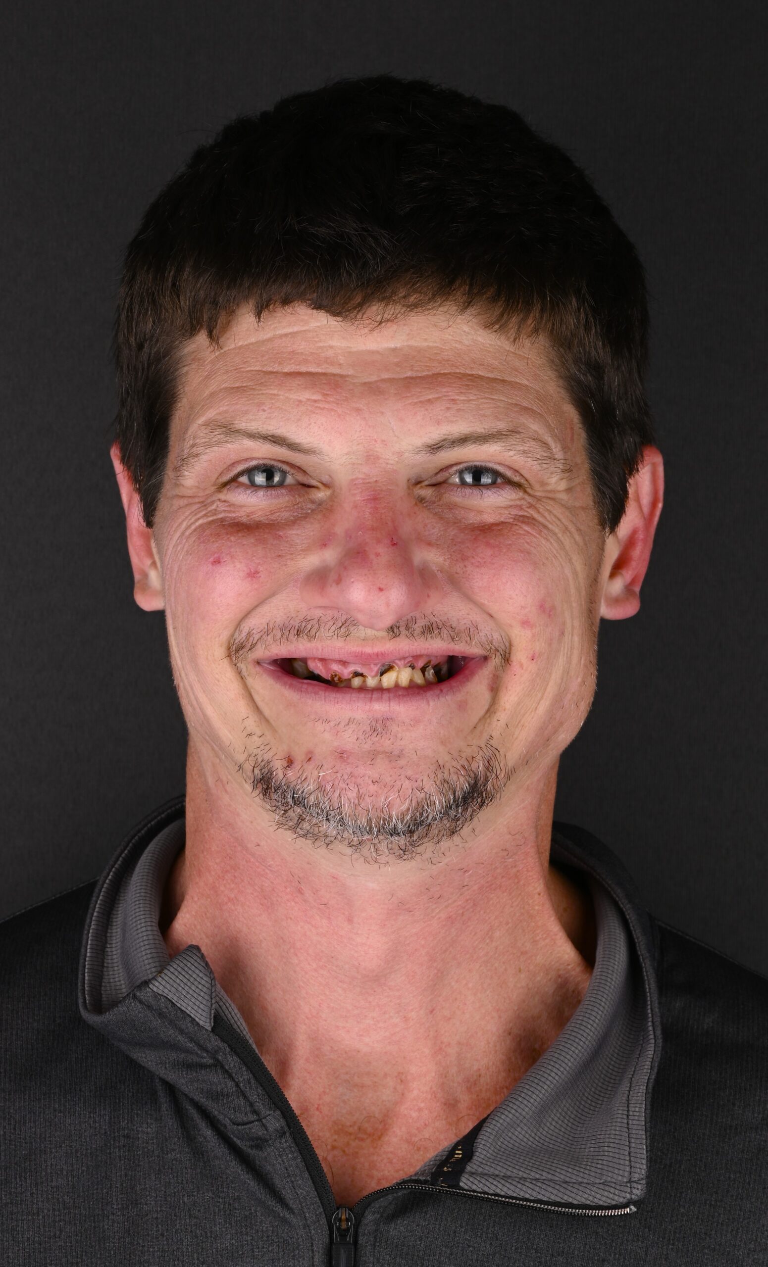 Close-up portrait of a smiling man with short dark hair, light stubble, and visible dental issues, wearing a dark zip-up jacket against a dark background.