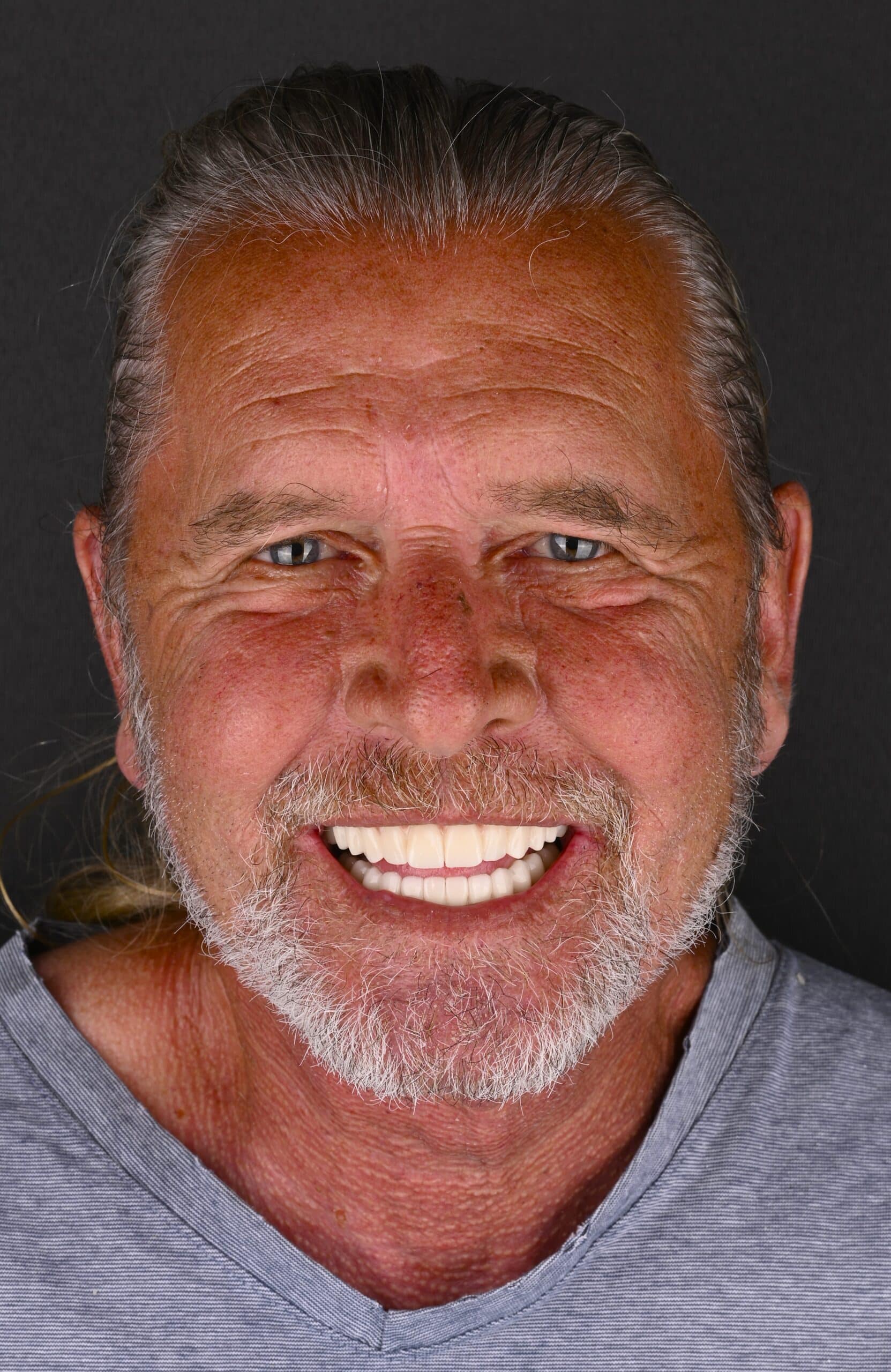 Smiling older man with gray hair and stubble, wearing a light blue shirt, against a dark background, close-up photo