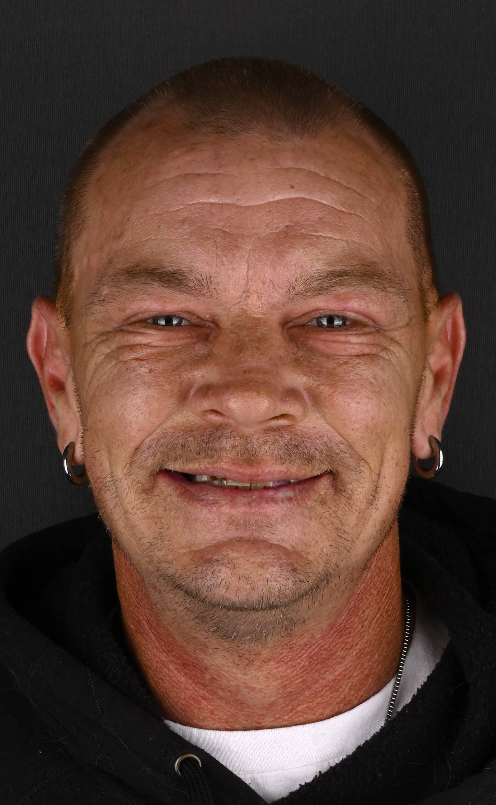 Front-facing portrait of a smiling man with a shaved head and ear gauges, wearing a black hoodie, against a dark background.
