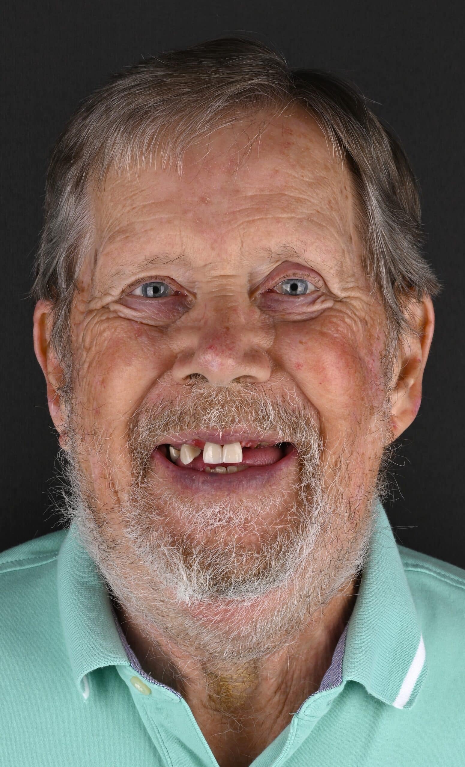 Close-up of an elderly man smiling, with gray hair and beard, wearing a mint green polo shirt against a dark background.