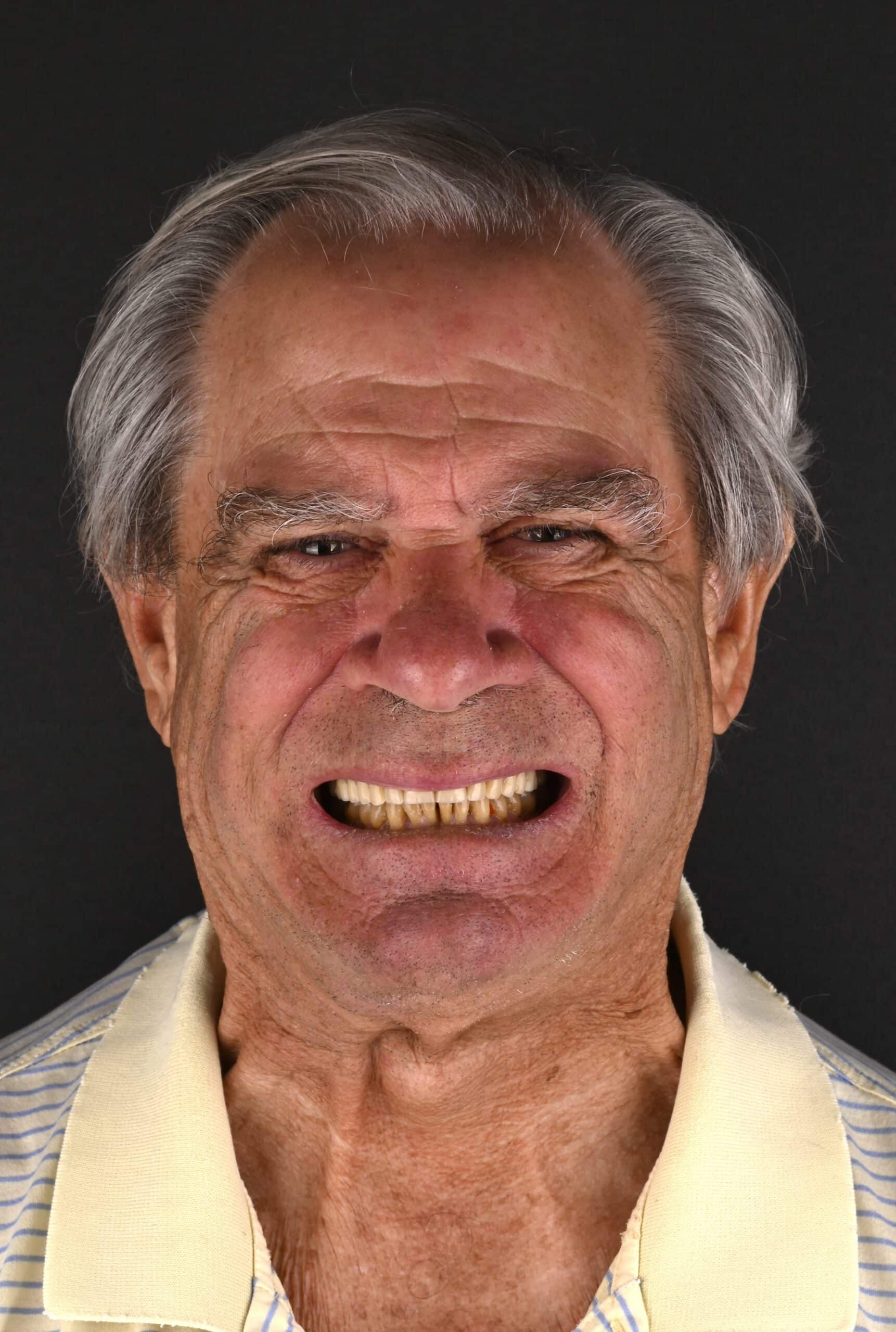 Close-up of an older man smiling broadly, gray hair, wearing a light striped shirt with a pale yellow collar against a dark background.