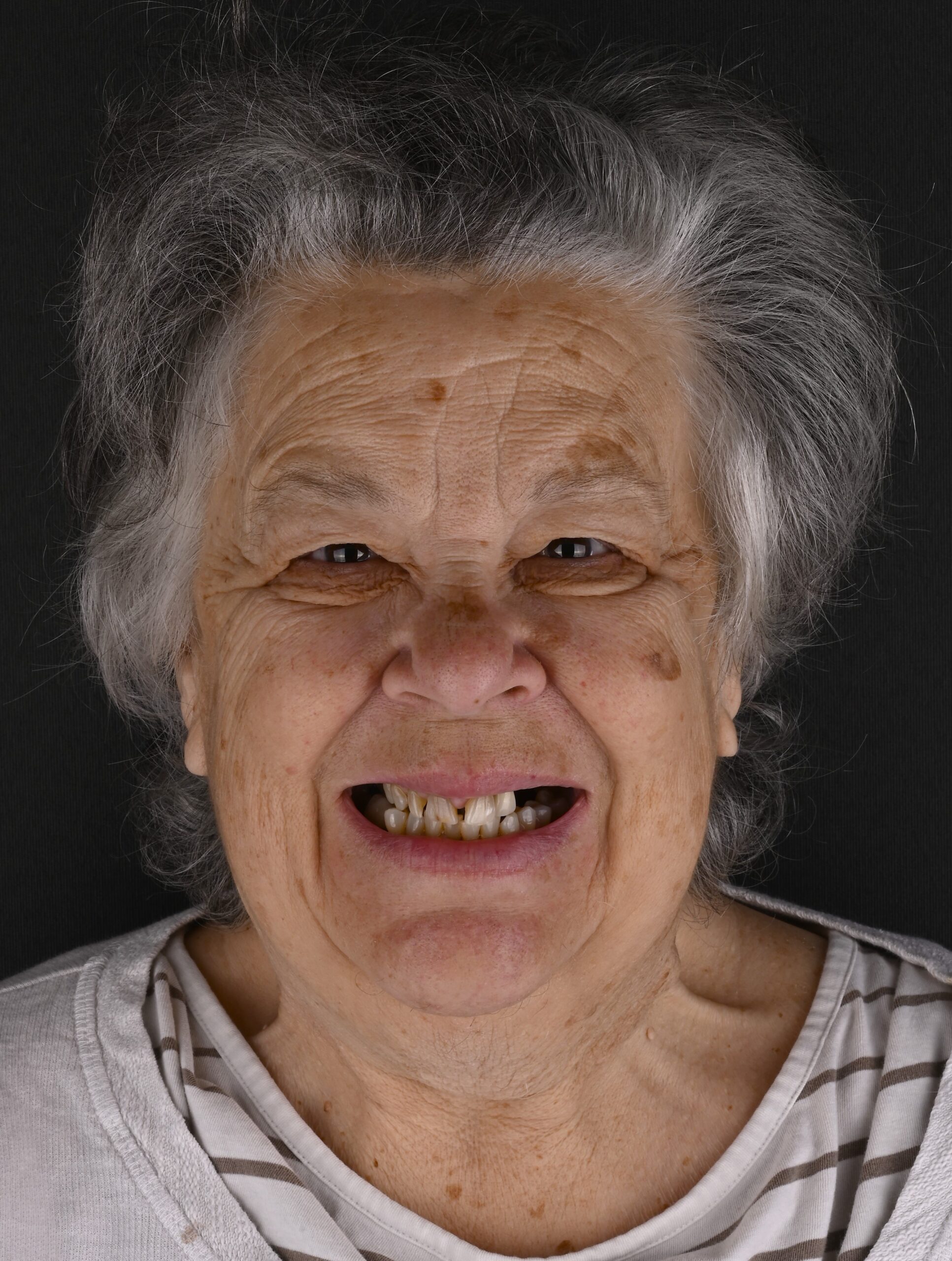 Close-up of an elderly woman smiling, showing some teeth, with gray hair and wrinkled skin against a dark background.