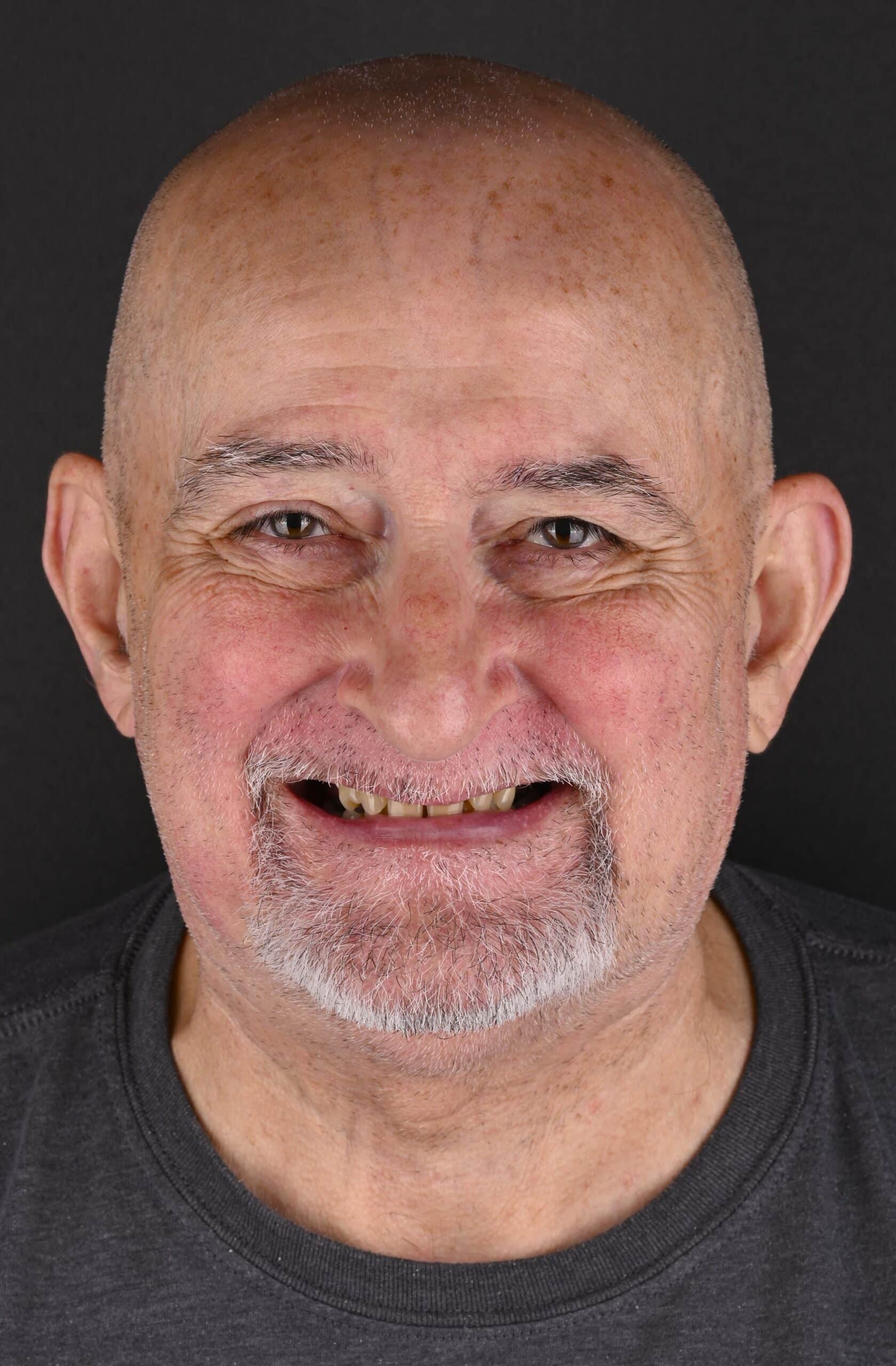 Close-up of smiling older man with a shaved head and gray beard wearing a black shirt against a dark background.