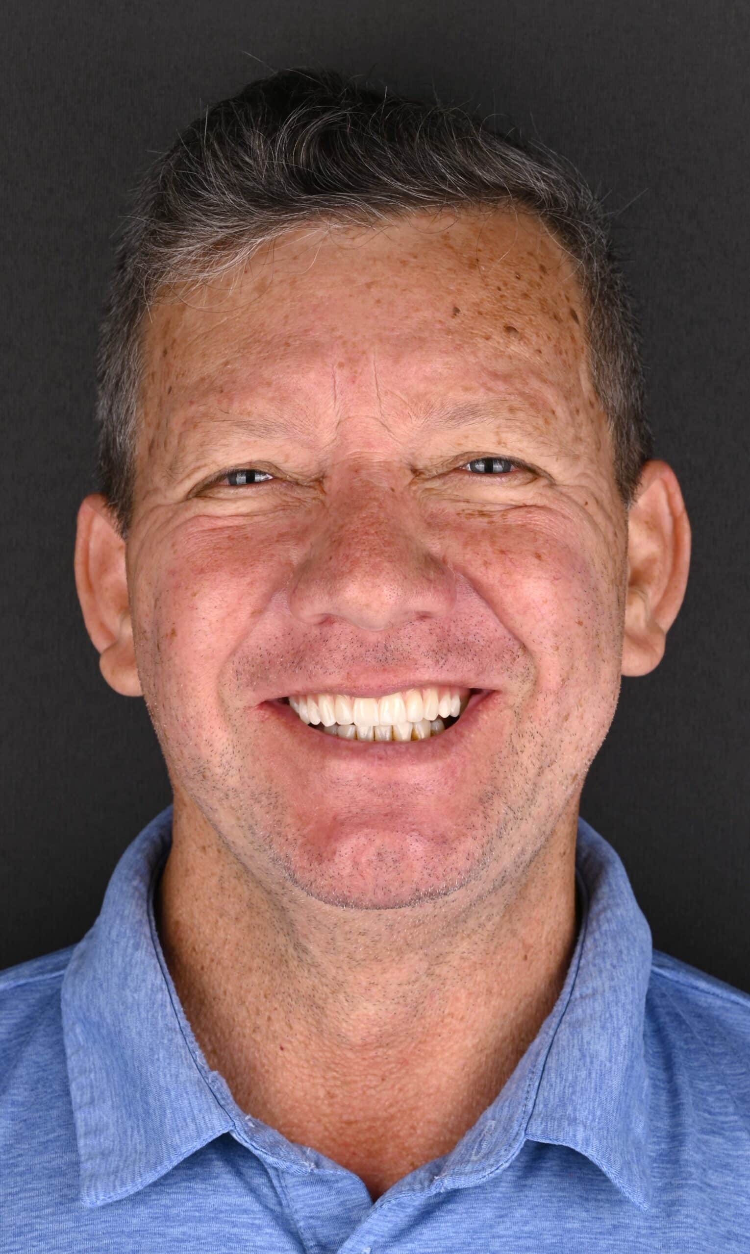 Close-up portrait of a smiling man with short dark hair, freckles, and a blue shirt against a dark background.