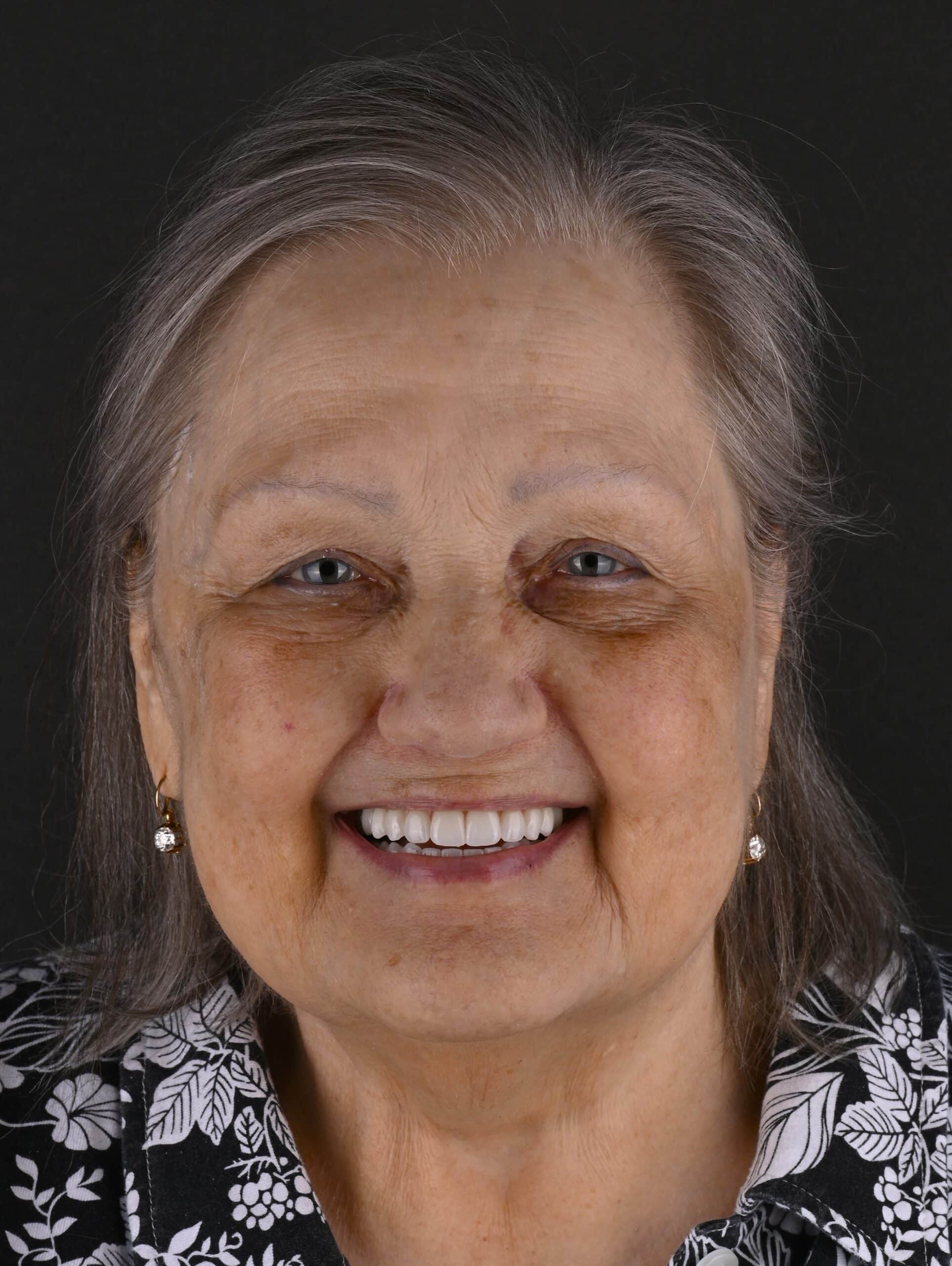 Smiling elderly woman with gray hair, wearing a black and white floral shirt, close-up of face against dark background.