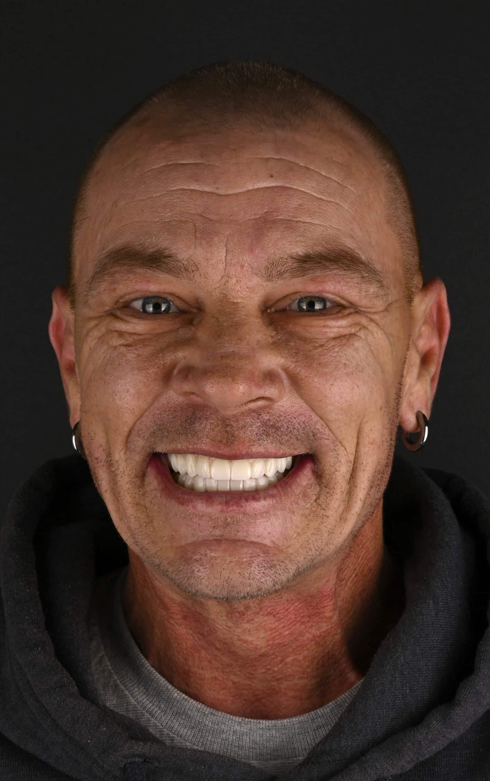 Close-up of a man with a wide grin, showing teeth, wearing hoop earrings against a dark background.