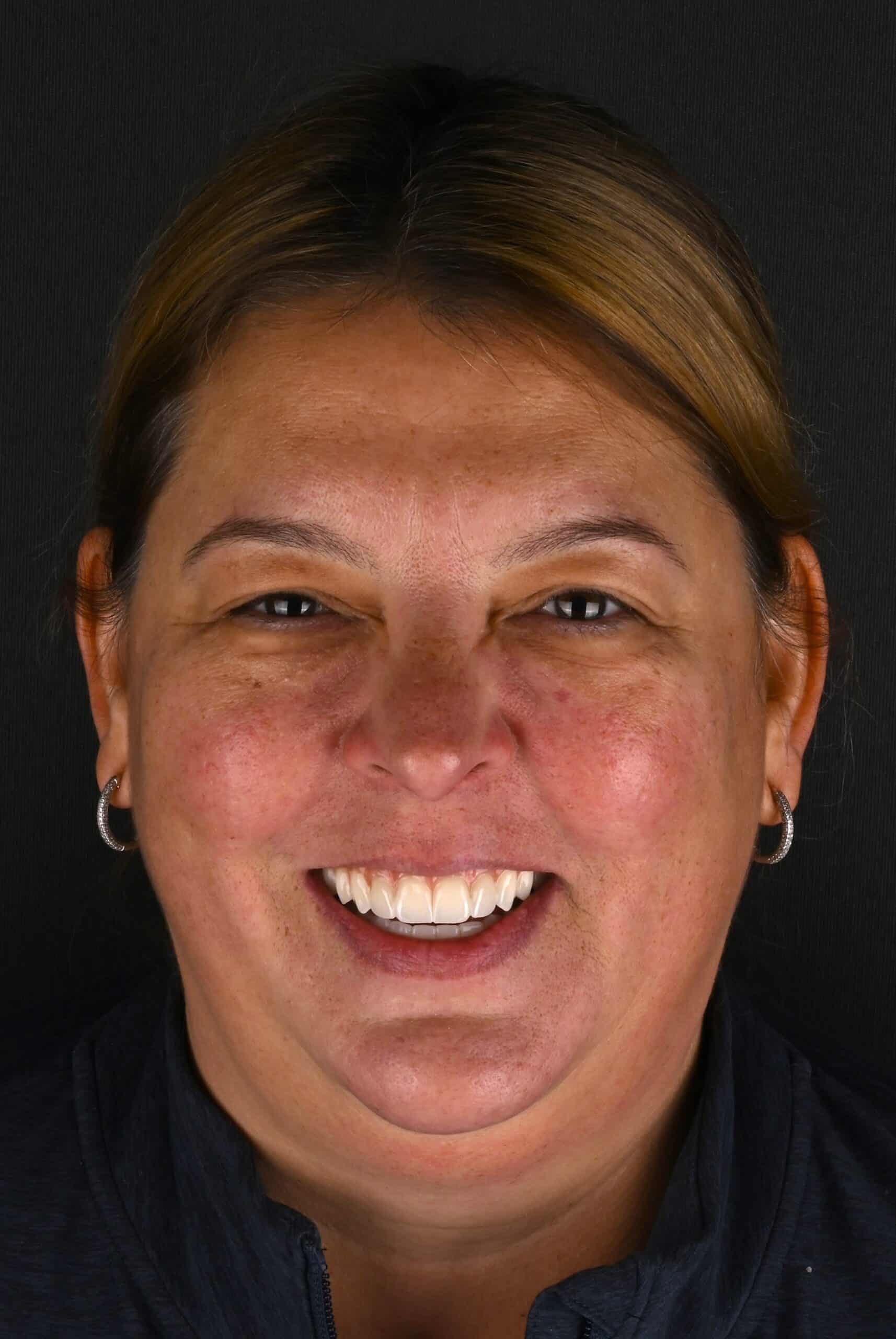 Close-up of a smiling woman with short brown-blonde hair and silver hoop earrings against a dark background.