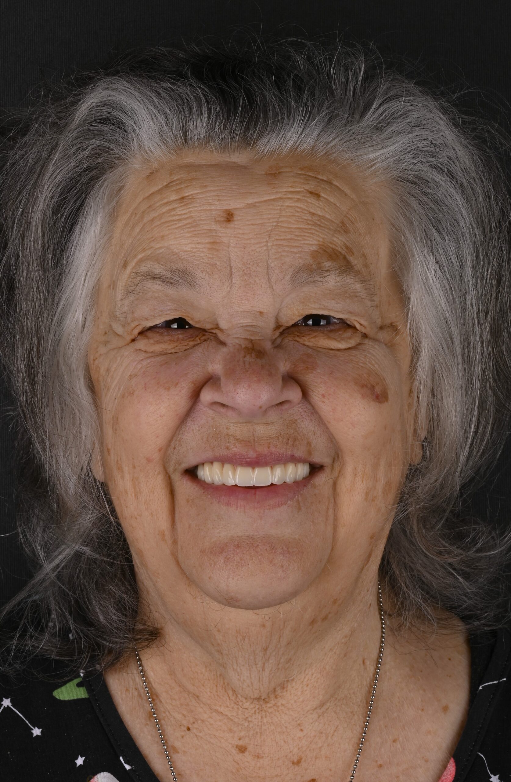 Close-up of an elderly woman smiling, with gray hair and freckles against a dark background.