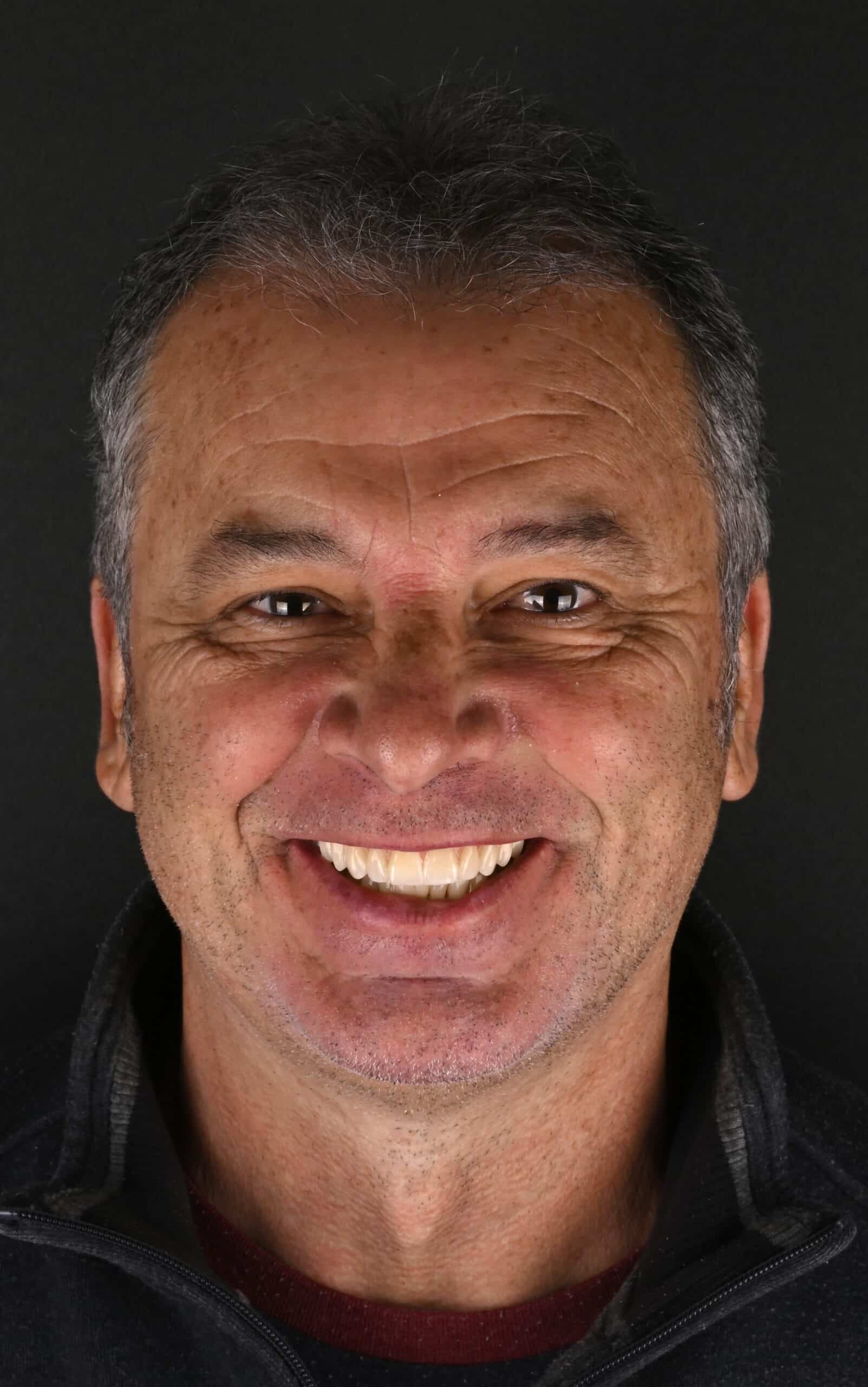 Close-up of a smiling man with short dark hair and freckles against a black background.