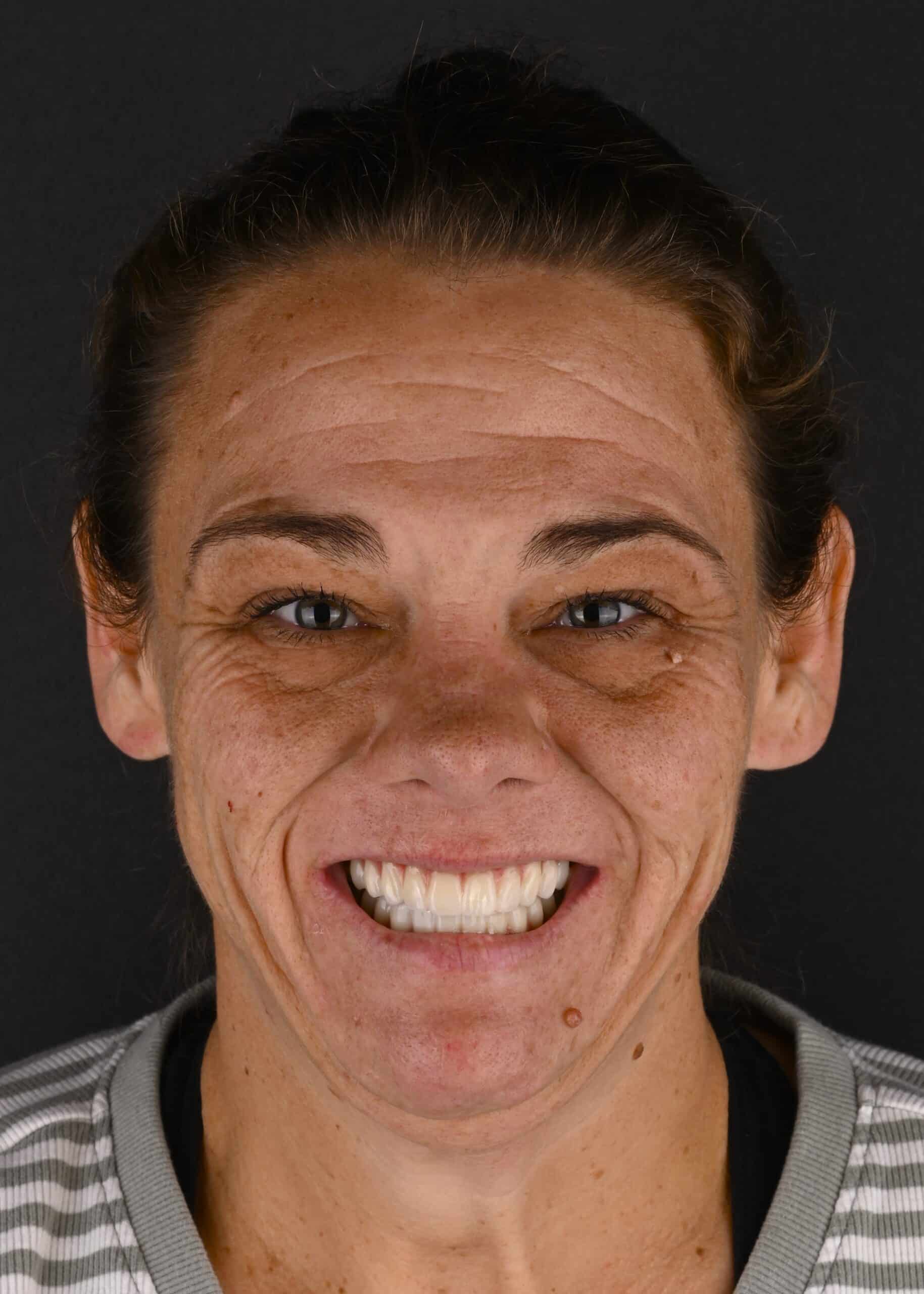 Close-up portrait of a woman smiling, with pulled-back hair and visible forehead wrinkles against a dark background.