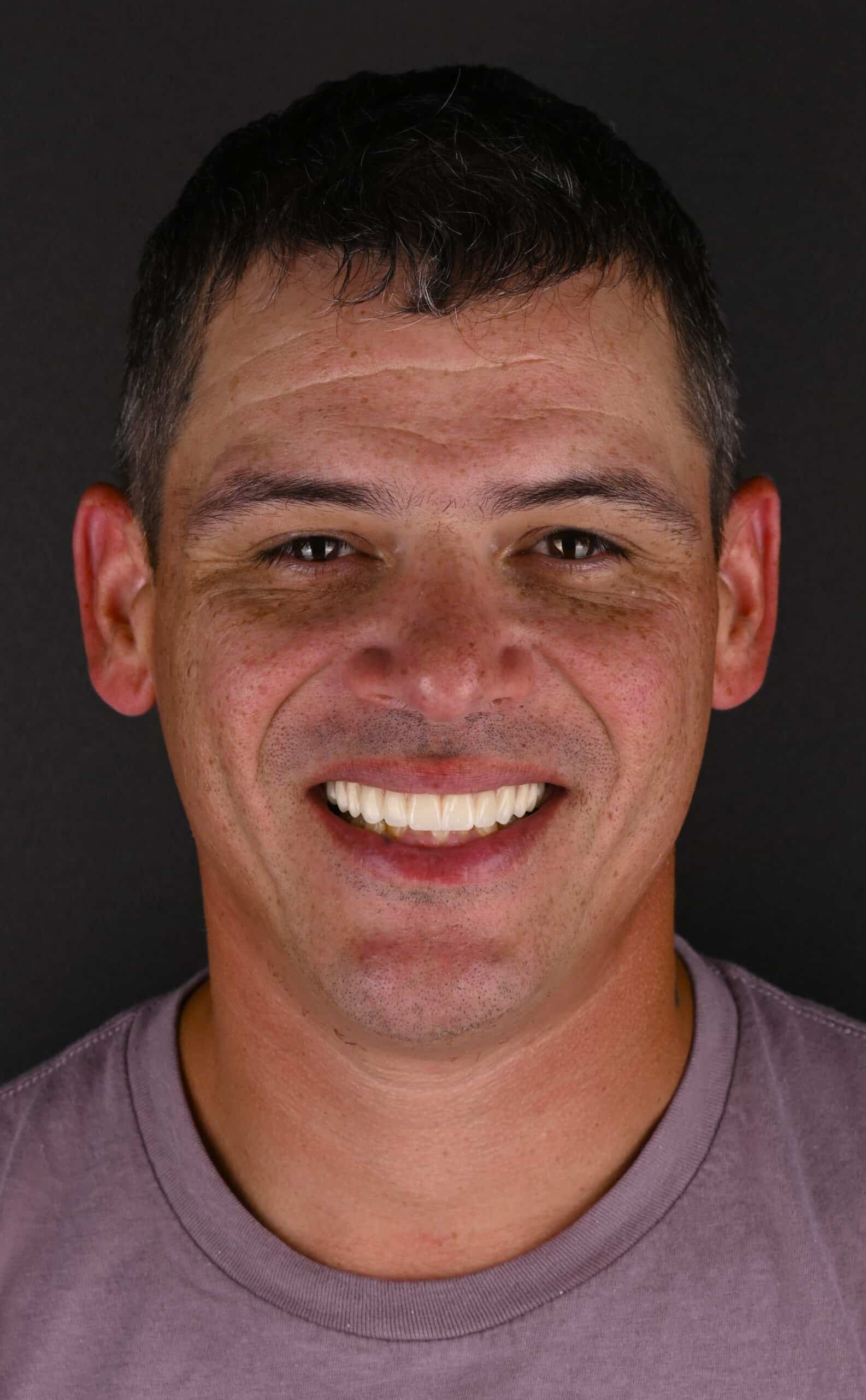 Close-up portrait of a smiling man with short dark hair and freckles, wearing a purple shirt against a black background.
