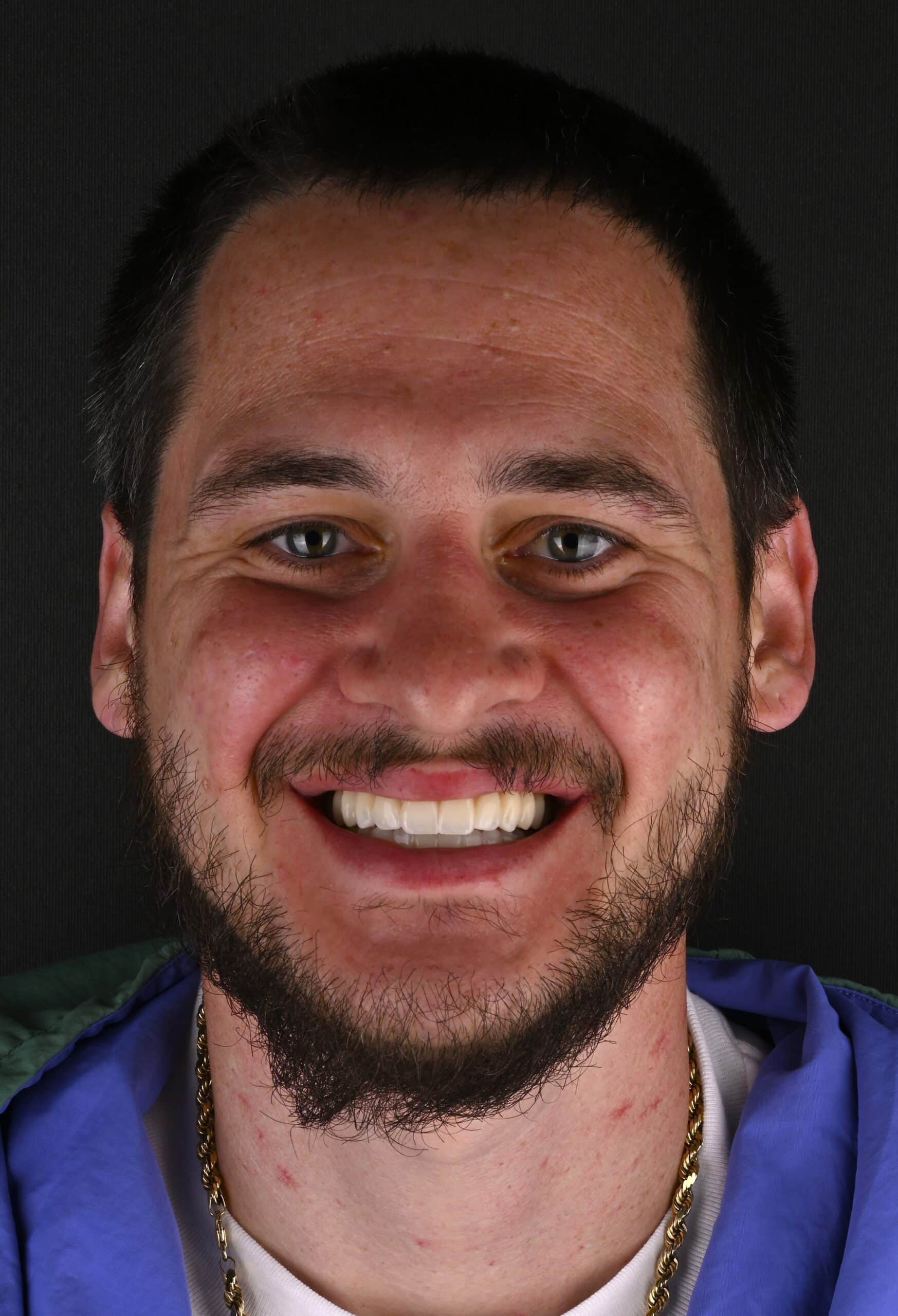 Close-up of a smiling man with short dark hair and a trimmed beard, wearing a blue jacket against a dark background.