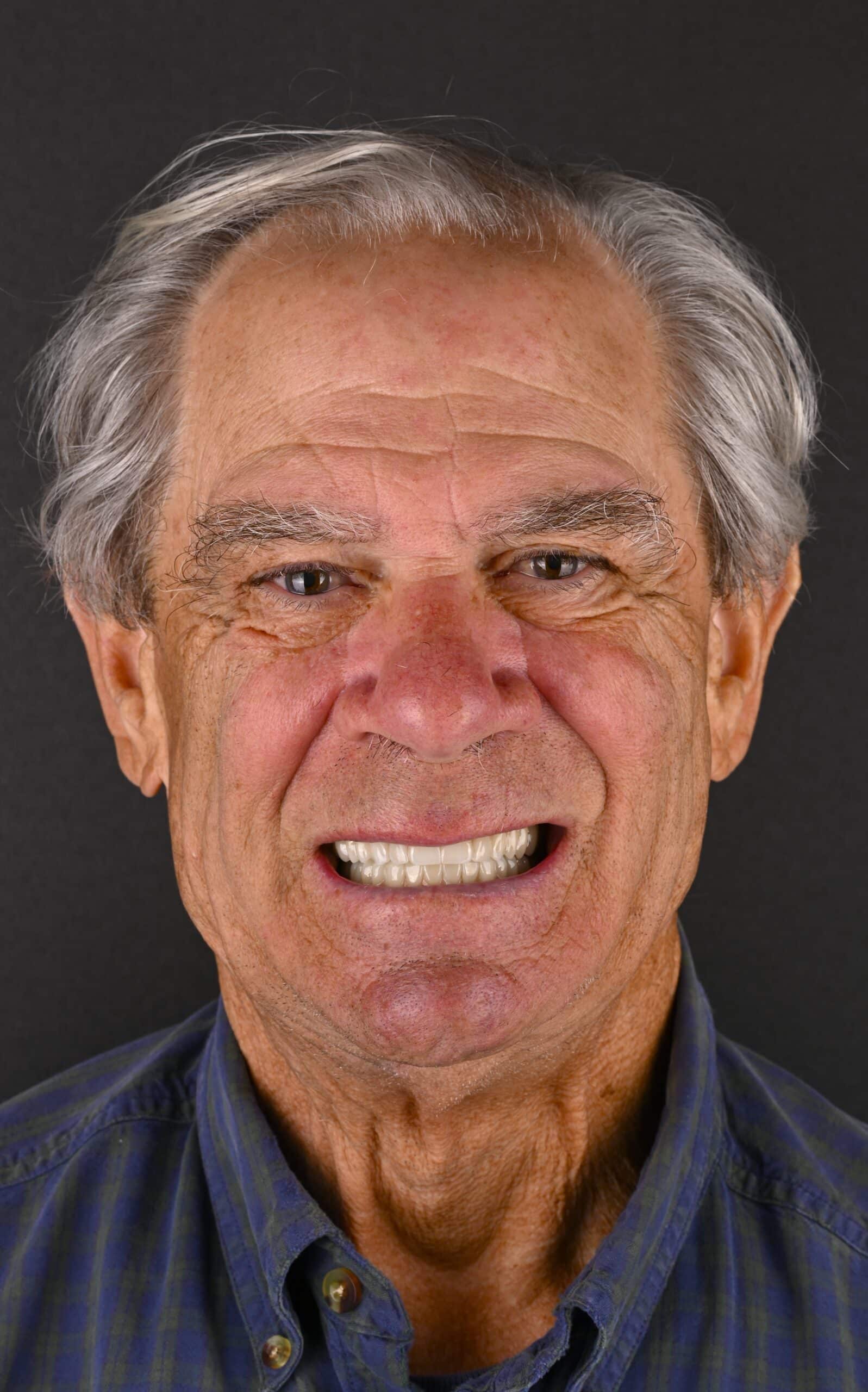 Close-up portrait of a smiling older man with gray hair against a dark background, wearing a blue striped shirt.
