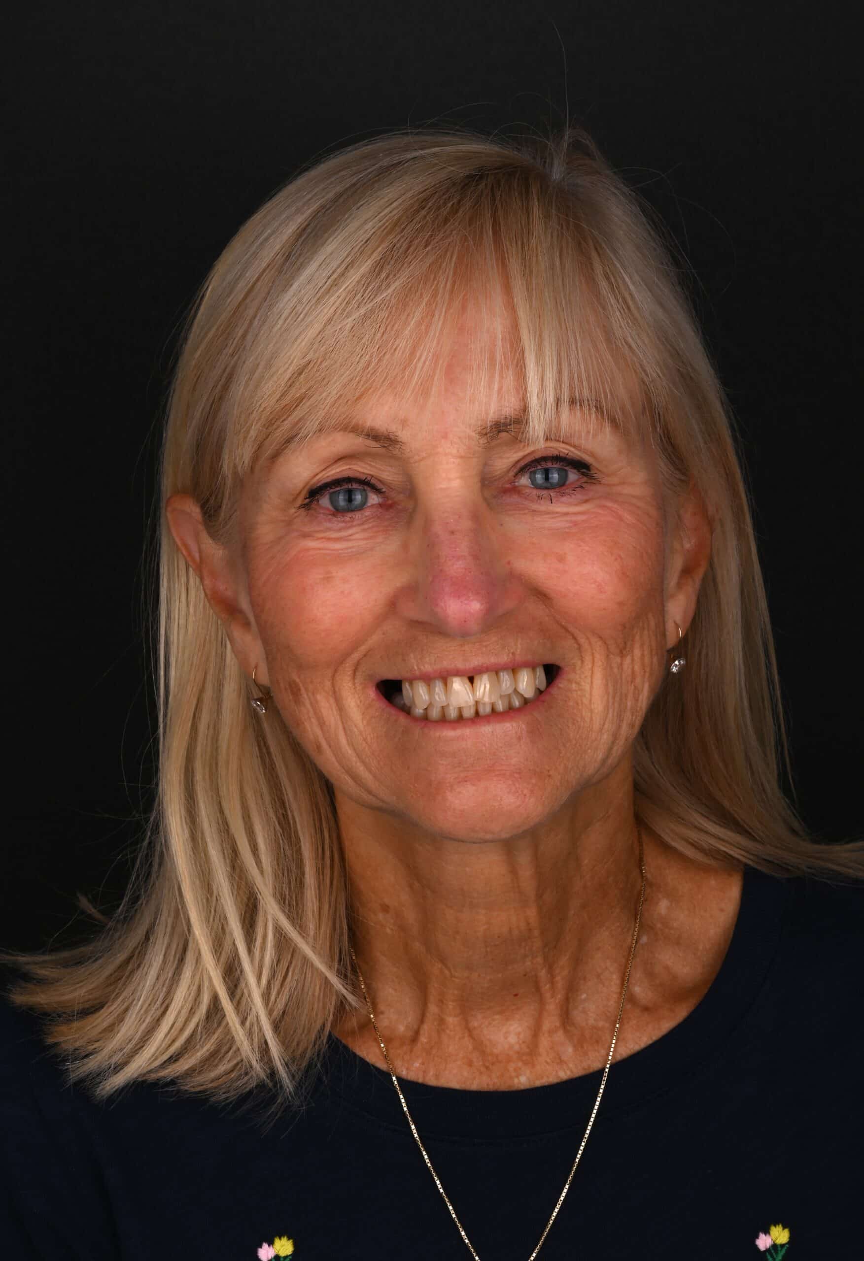 Close-up portrait of a smiling woman with blonde hair and blue eyes against a black background, wearing a dark top and a delicate necklace.