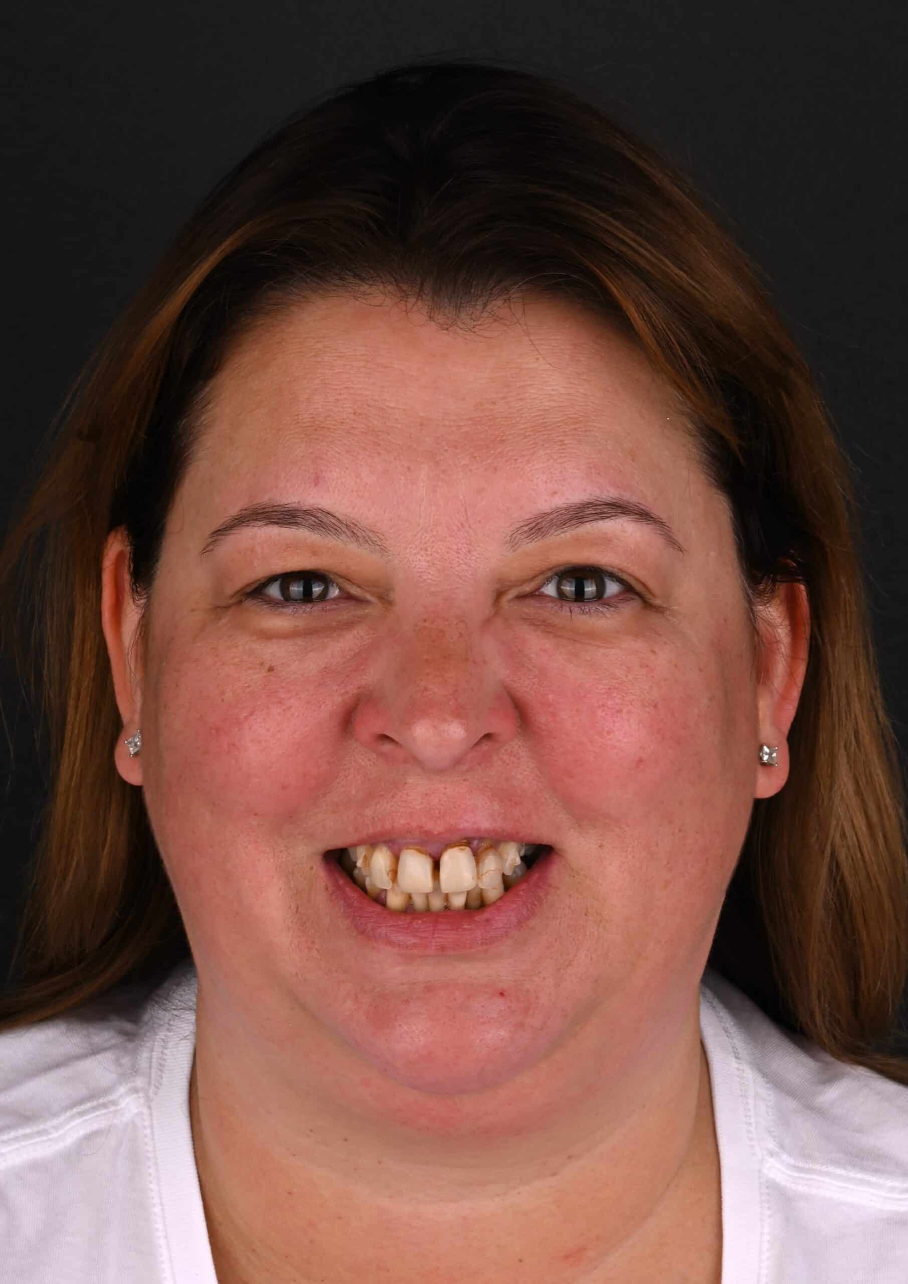 Close-up of a woman facing the camera, smiling with teeth visible, brown hair, wearing a white shirt, dark background.
